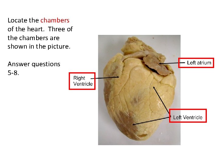 Locate the chambers of the heart. Three of the chambers are shown in the