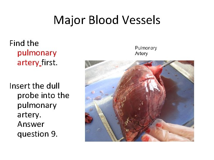 Major Blood Vessels Find the pulmonary artery first. Insert the dull probe into the