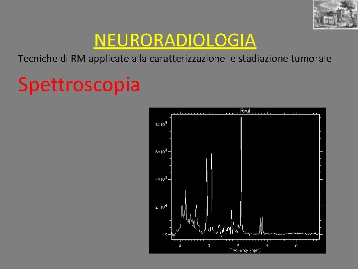 NEURORADIOLOGIA Tecniche di RM applicate alla caratterizzazione e stadiazione tumorale Spettroscopia 