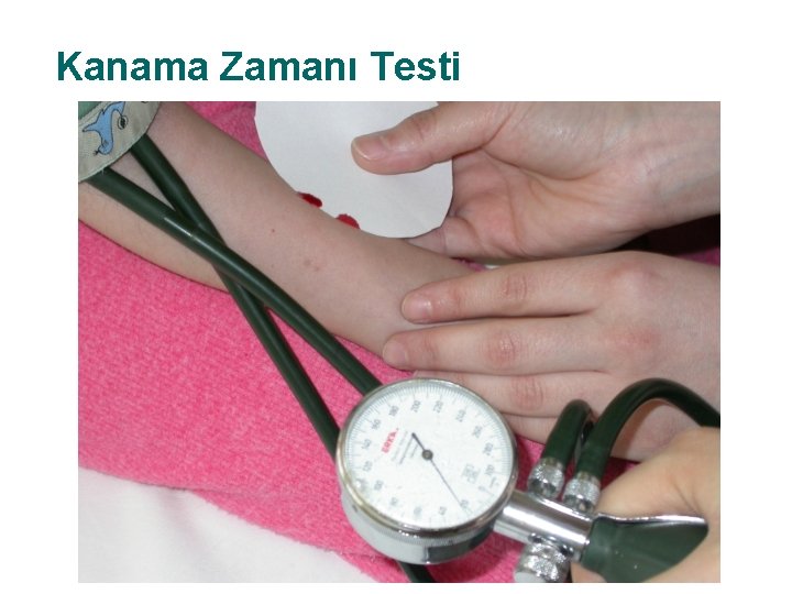 Kanama Zamanı Testi 