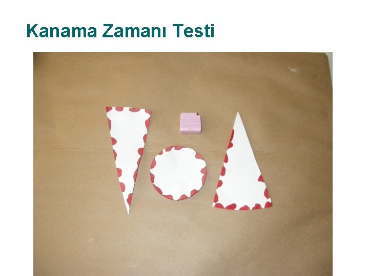 Kanama Zamanı Testi 