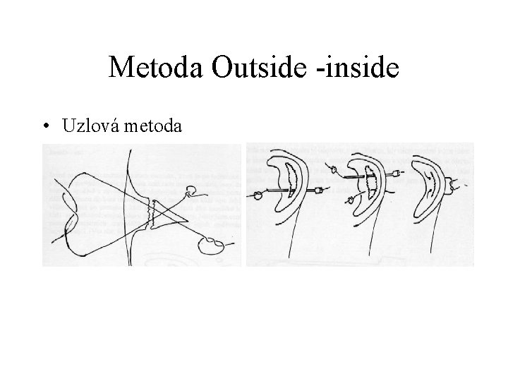 Metoda Outside -inside • Uzlová metoda 