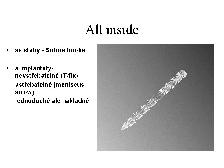 All inside • se stehy - Suture hooks • s implantátynevstřebatelné (T-fix) vstřebatelné (meniscus