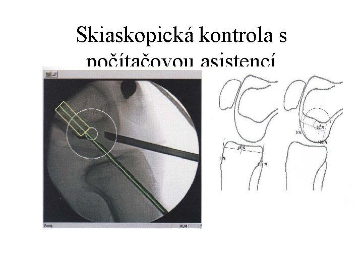 Skiaskopická kontrola s počítačovou asistencí 