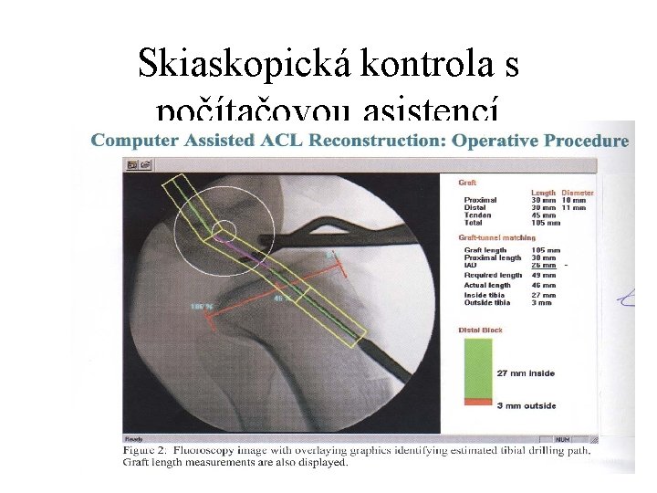 Skiaskopická kontrola s počítačovou asistencí 