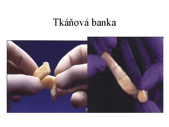 Tkáňová banka 