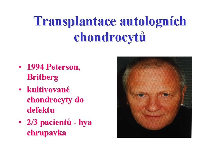 Transplantace autologních chondrocytů • 1994 Peterson, Britberg • kultivované chondrocyty do defektu • 2/3