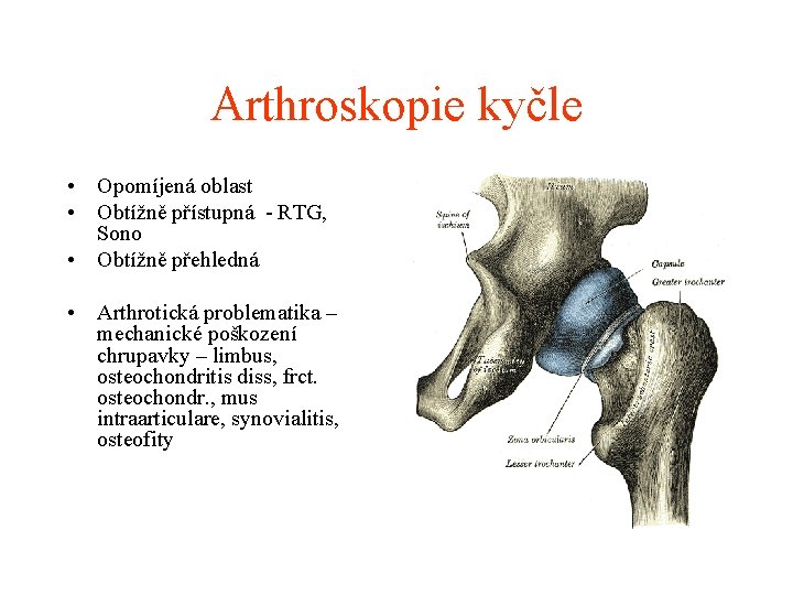 Arthroskopie kyčle • Opomíjená oblast • Obtížně přístupná - RTG, Sono • Obtížně přehledná