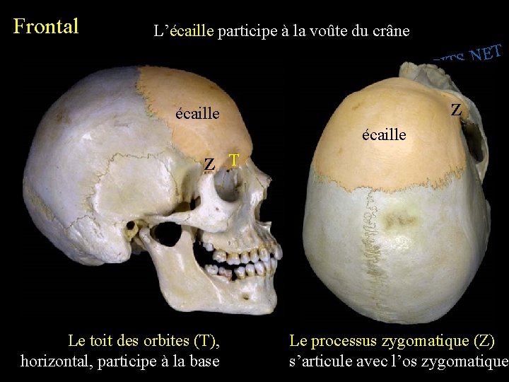 Frontal L’écaille participe à la voûte du crâne T E N. S SPIT I.