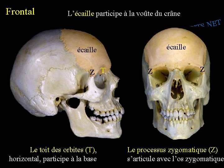 Frontal L’écaille participe à la voûte du crâne T E N. S SPIT I.