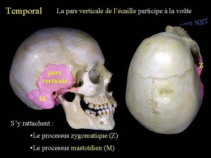 Temporal La pars verticale de l’écaille participe à la voûte T E N. S