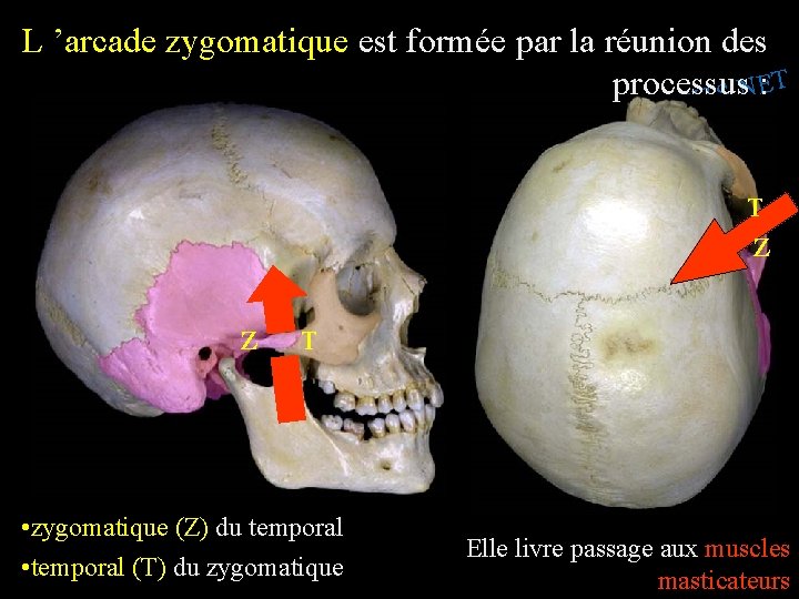 L ’arcade zygomatique est formée par la réunion des T E processus : N.