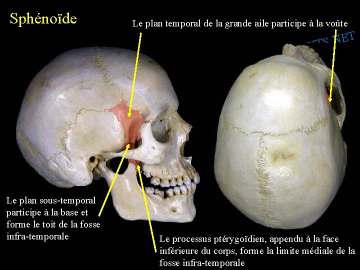 Sphénoïde Le plan temporal de la grande aile participe à la voûte T E