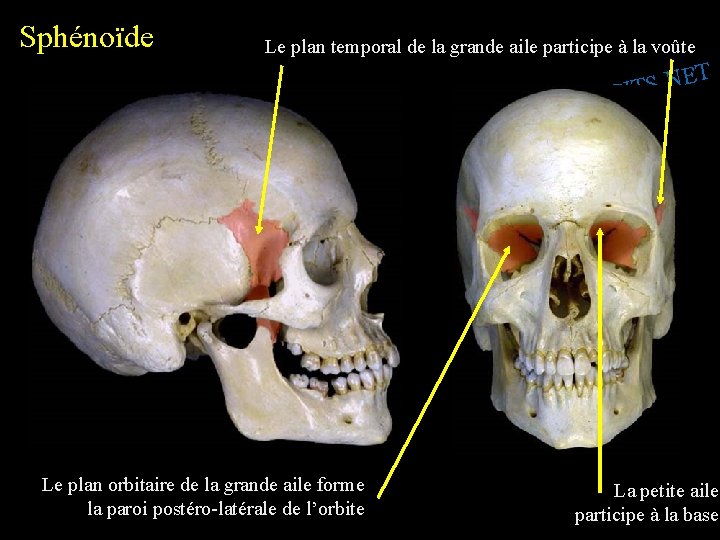 Sphénoïde Le plan temporal de la grande aile participe à la voûte T E