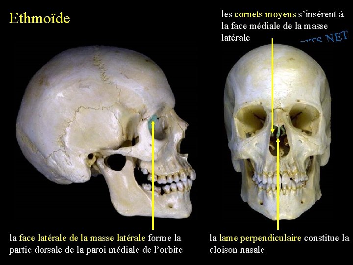 Ethmoïde les cornets moyens s’insèrent à la face médiale de la masse latérale S.