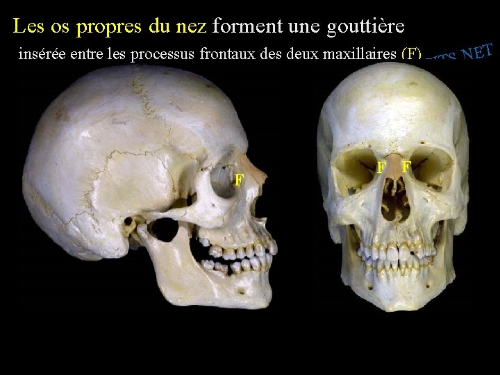 Les os propres du nez forment une gouttière insérée entre les processus frontaux des