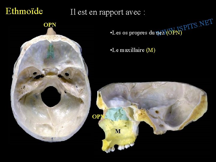 Ethmoïde Il est en rapport avec : T E N. S PIT S I.