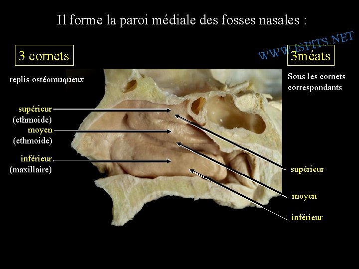 Il forme la paroi médiale des fosses nasales : 3 cornets replis ostéomuqueux W