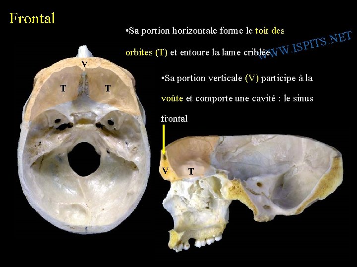 Frontal • Sa portion horizontale forme le toit des T E N. S PIT