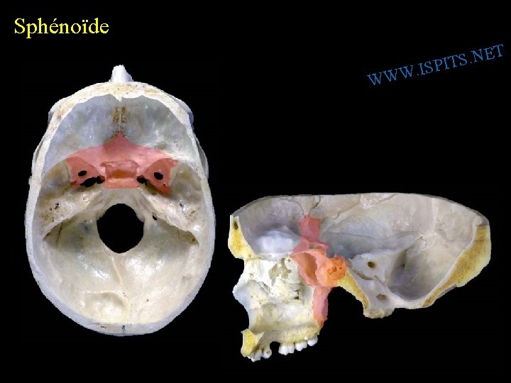 Sphénoïde W T E N. S SPIT I. W W 