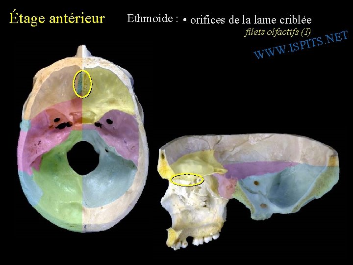 Étage antérieur Ethmoide : • orifices de la lame criblée filets olfactifs (I) W