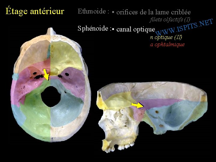 Étage antérieur Ethmoide : • orifices de la lame criblée filets olfactifs (I) Sphénoide