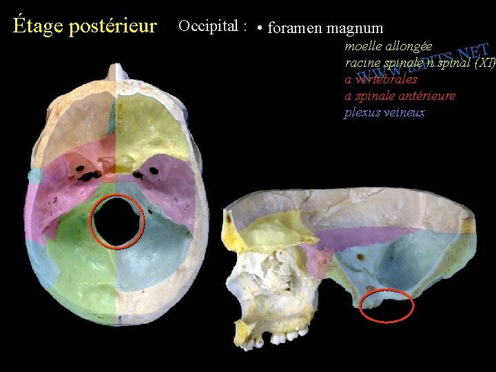 Étage postérieur Occipital : • foramen magnum moelle allongée T E N. S racine