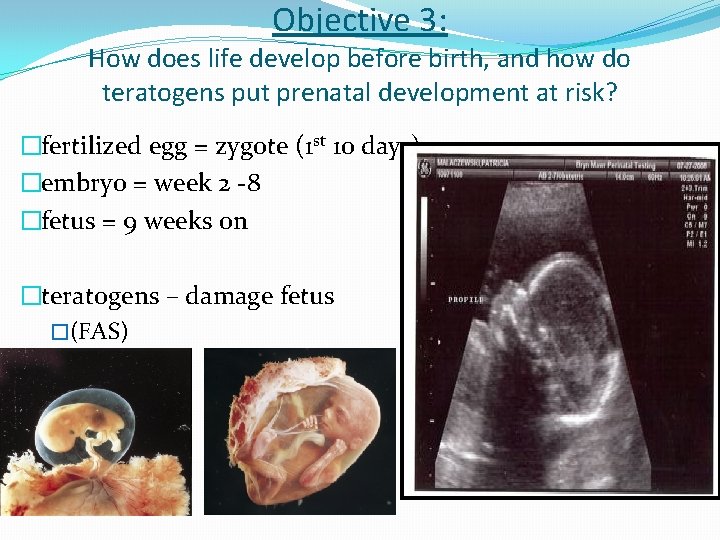 Objective 3: How does life develop before birth, and how do teratogens put prenatal