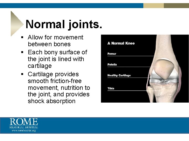 Normal joints. § Allow for movement between bones § Each bony surface of the