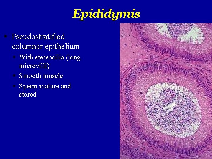 Epididymis Pseudostratified columnar epithelium With stereocilia (long microvilli) Smooth muscle Sperm mature and stored