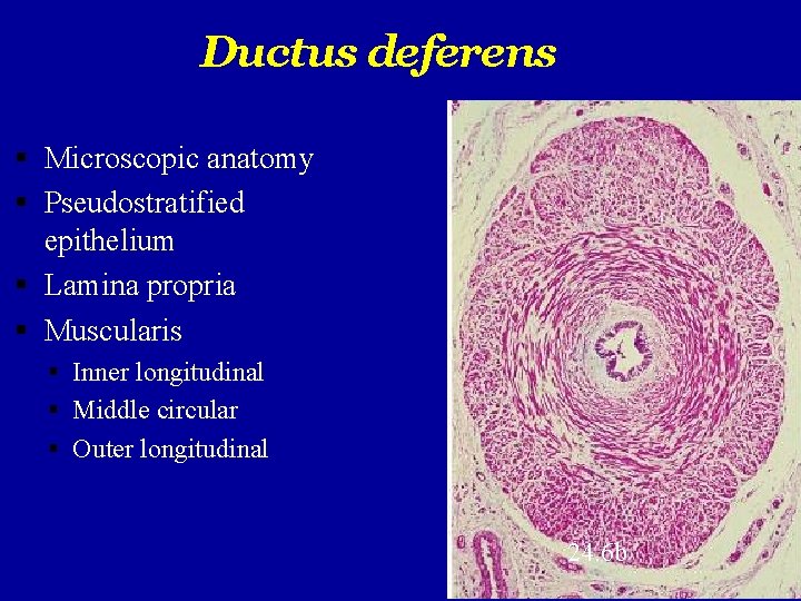 Ductus deferens Microscopic anatomy Pseudostratified epithelium Lamina propria Muscularis Inner longitudinal Middle circular Outer