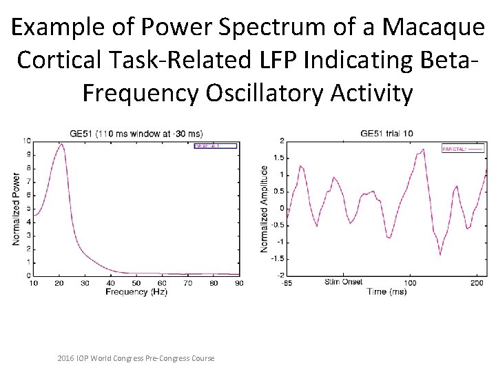 Example of Power Spectrum of a Macaque Cortical Task-Related LFP Indicating Beta. Frequency Oscillatory