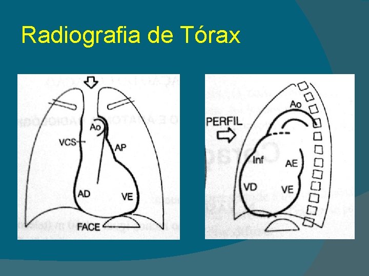 Radiografia de Tórax 