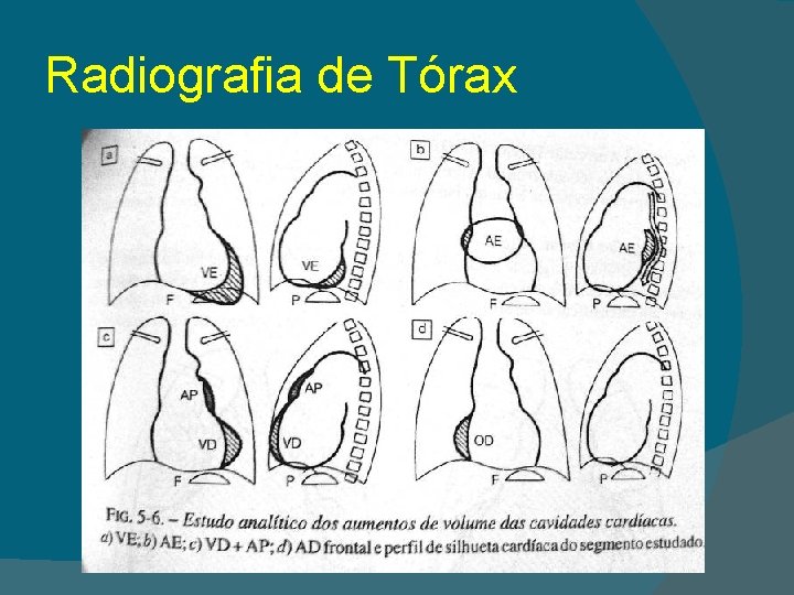 Radiografia de Tórax 