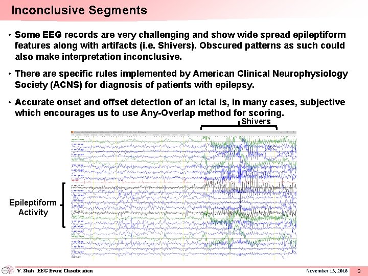 Inconclusive Segments • Some EEG records are very challenging and show wide spread epileptiform