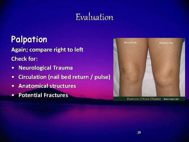 Evaluation Palpation Again; compare right to left Check for: • Neurological Trauma • Circulation