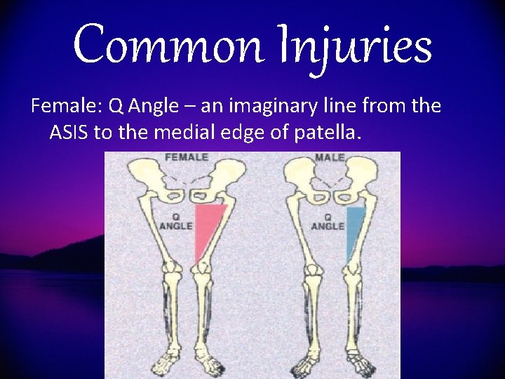 Common Injuries Female: Q Angle – an imaginary line from the ASIS to the