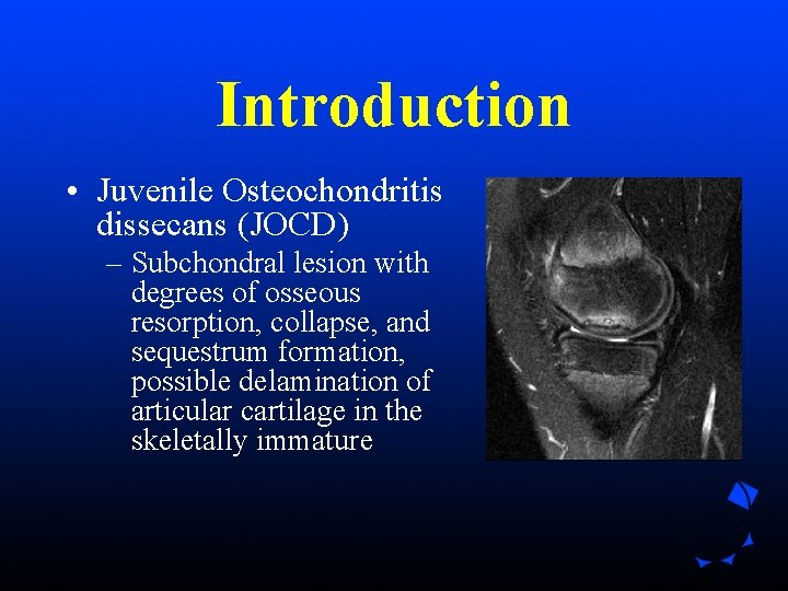 Introduction • Juvenile Osteochondritis dissecans (JOCD) – Subchondral lesion with degrees of osseous resorption, Introduction • Juvenile Osteochondritis dissecans (JOCD) – Subchondral lesion with degrees of osseous resorption,
