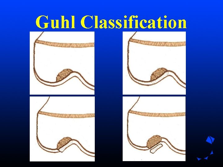 Guhl Classification Guhl Classification