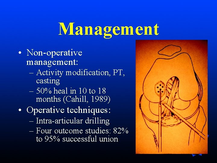 Management • Non-operative management: – Activity modification, PT, casting – 50% heal in 10 Management • Non-operative management: – Activity modification, PT, casting – 50% heal in 10