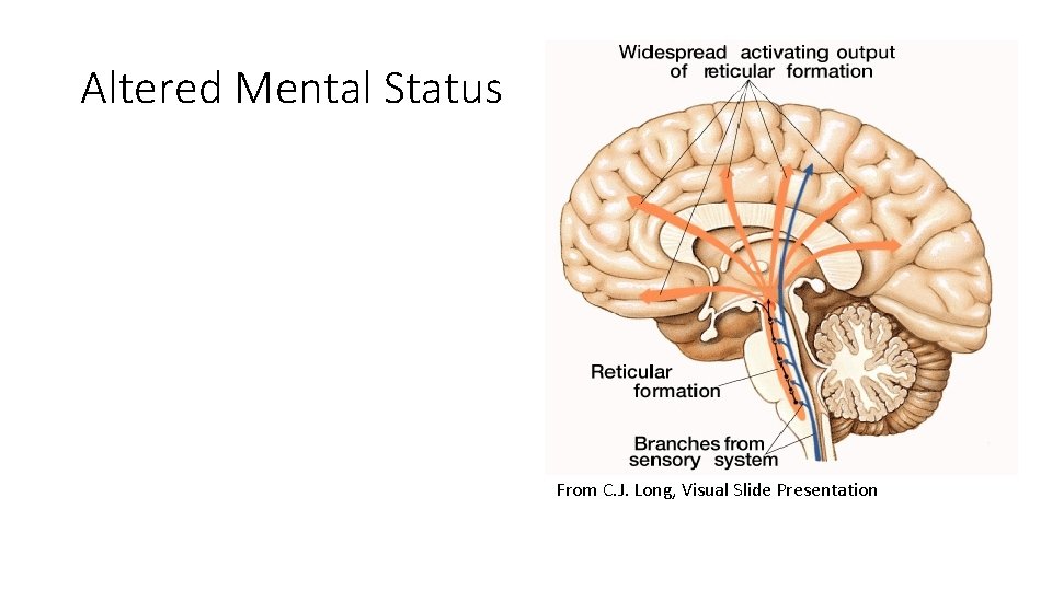 Altered Mental Status From C. J. Long, Visual Slide Presentation 