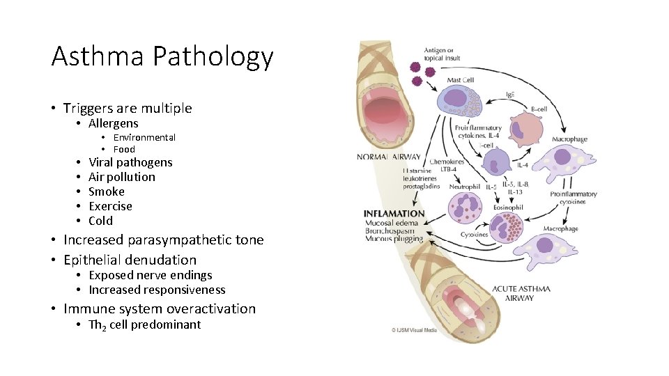 Asthma Pathology • Triggers are multiple • Allergens • • • Environmental • Food