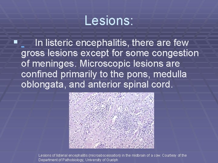 Lesions: § In listeric encephalitis, there are few gross lesions except for some congestion