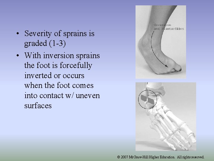 Inverted Injuries Chapter 15 The Ankle and Lower Leg Injuries