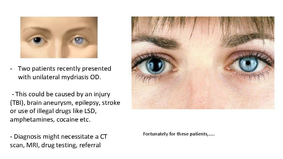 - Two patients recently presented with unilateral mydriasis OD. - This could be caused