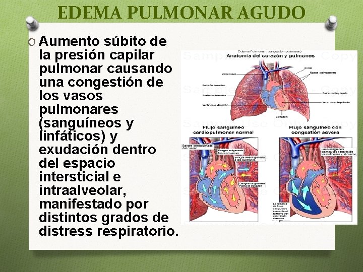 EDEMA PULMONAR AGUDO O Aumento súbito de la presión capilar pulmonar causando una congestión