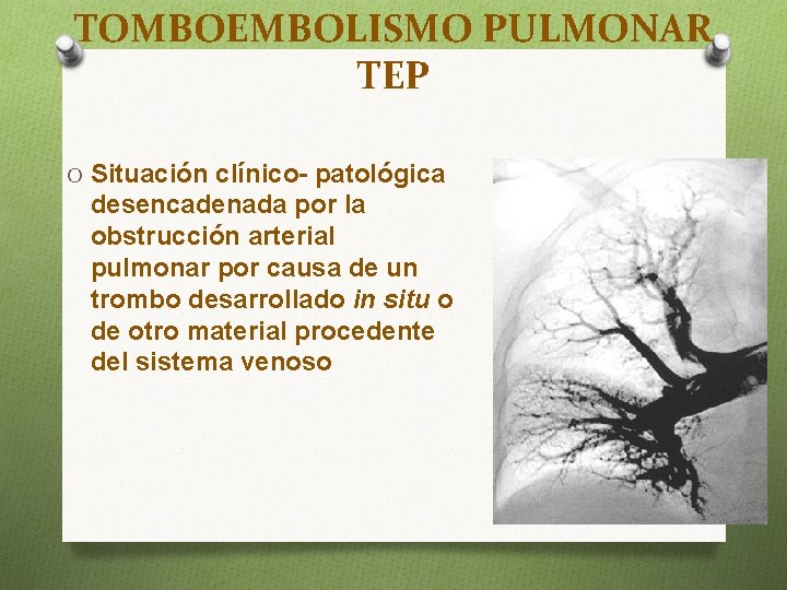 TOMBOEMBOLISMO PULMONAR TEP O Situación clínico- patológica desencadenada por la obstrucción arterial pulmonar por