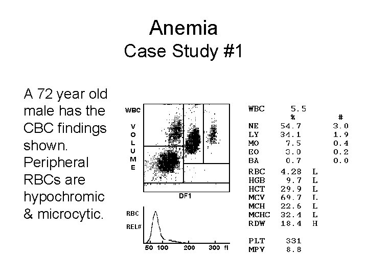 Anemia Case Study #1 A 72 year old male has the CBC findings shown.