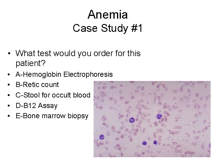 Anemia Case Study #1 • What test would you order for this patient? •