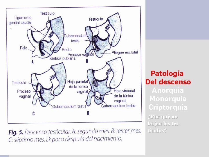 Patología Del descenso Anorquia Monorquia Criptorquia ¿Por qué no bajan los testículos? 